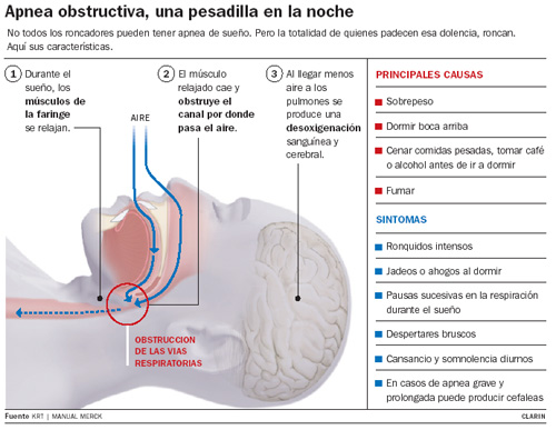 Cómo se solucionan los ronquidos y la apnea del sueño? 